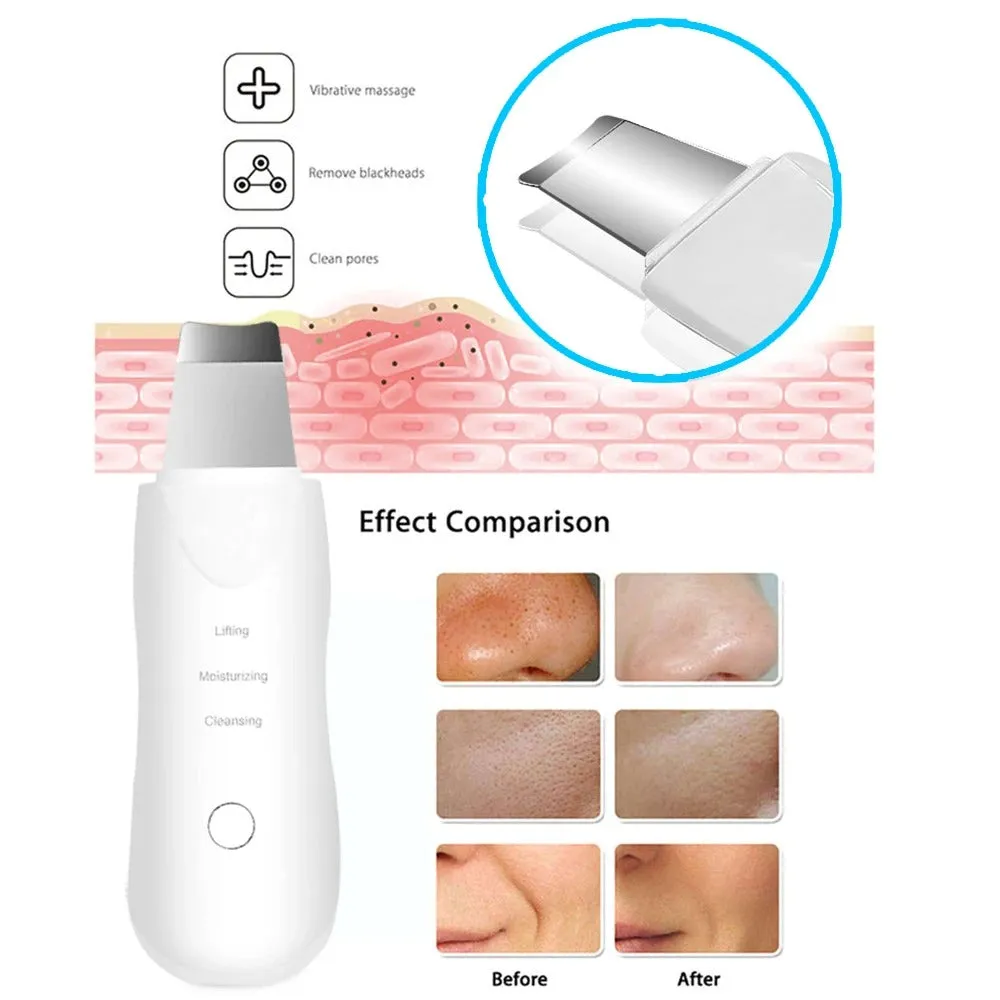 17056 1b-051 limpiador Facial con vibración profunda 1 Pza