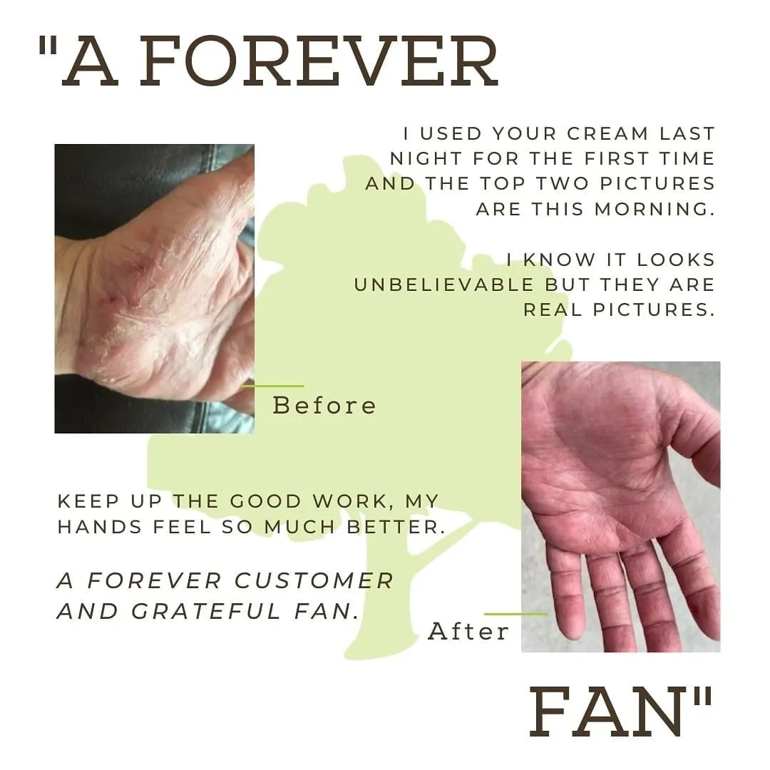 Hand Cream